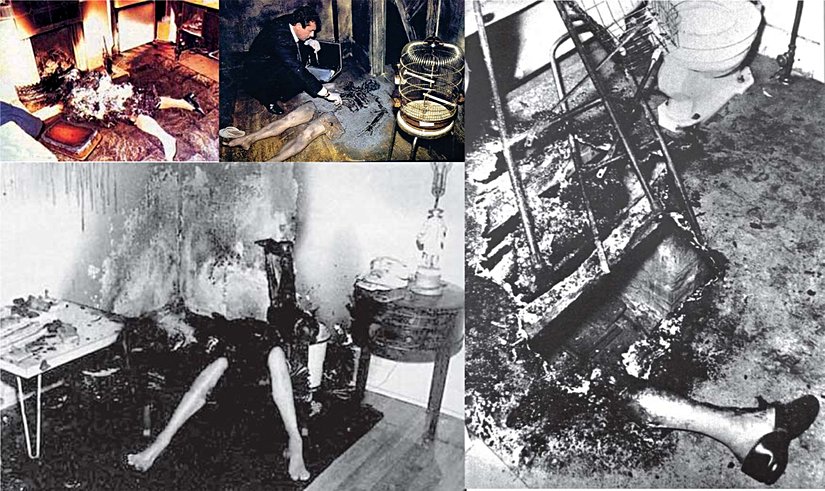 Spontane İnsan Yanması Vakaları