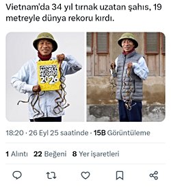 Neden tırnaklarımız uzamaya devam ediyor?