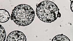 Abiyogenez Teorisi'nde Önemli Keşif: Metaller ve Enzimler Olmadan da Krebs Döngüsünün Çalışabildiği Gösterildi!