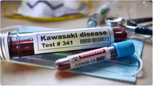 Study Links COVID-19 Infection To Increased Kawasaki Disease Risk