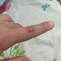 Parmak boğumlarının fizyolojisi ile su tüketimi arasında anlamlı bir ilişki var mı?