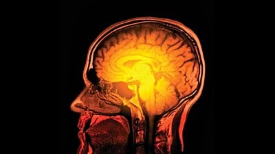 Beyin Dalgalarını Kim Keşfetti? Nazilerin Bu Konuyla İlgisi Ne?