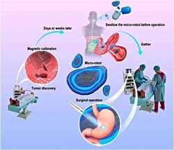 Yumuşak Robotlarla Mide Tümörlerinin Yerini Tespit Etmek Artık Mümkün!