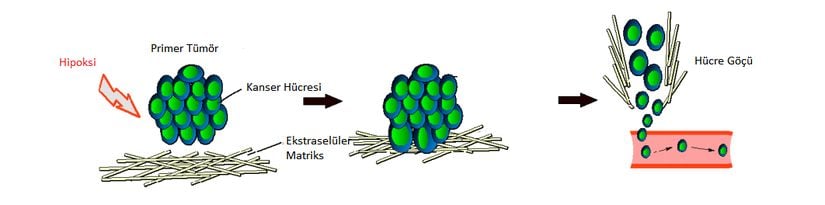 Hipoksi durumunda tümör hücreleri anjiyogenetik fenotipe sahip olur ve VEGF aracılığıyla endotel hücrelerinin geçirgenliğini artırarak metastaz sağlarlar.