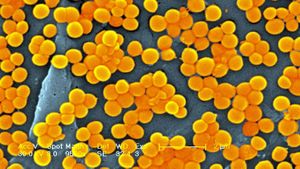 Experts Warn Of Rising Antibiotic Resistance Threats