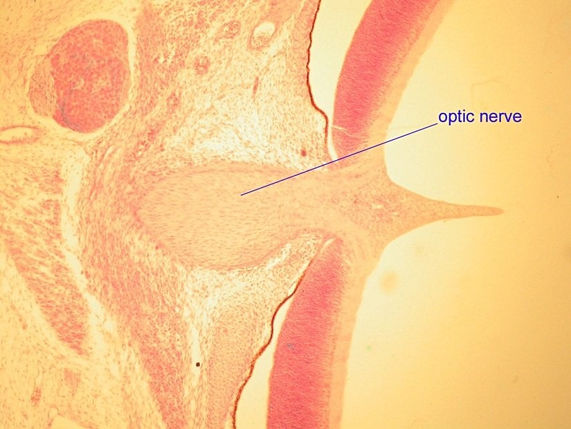 İnsanların gözünde kör nokta oluşmasına neden olan sinir yumağının dokusal düzeyde çekilmiş bir fotoğrafı... Bu nokta nedeniyle bu canlılar görüş alanı dahilindeki bazı bölgeleri göremezler. Göz, bir insan mühendisi tarafından bile, şu anda olduğundan kat kat iyi tasarlanabilirdi.