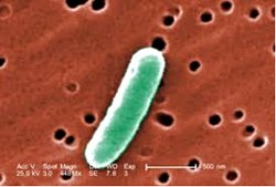 1M3 alana yan yana olmak şartıyla  kaç tane e. coli bakterisi sığar?