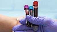 Breakthrough blood test detects chronic fatigue with 96% accuracy