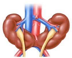 Horseshoe kidney(atnalı böbrek) açabileceği sıkıntılar ve nasıl önlem alınır?