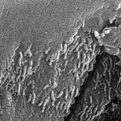 Early Microscopic Life on Mars?