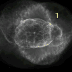 İnanılmaz Şekilde Genişleyen Kedi Gözü