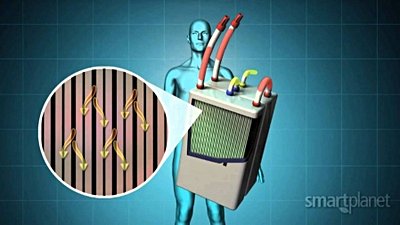 Yapay Böbrekler 2020 Yılında Geliyor!