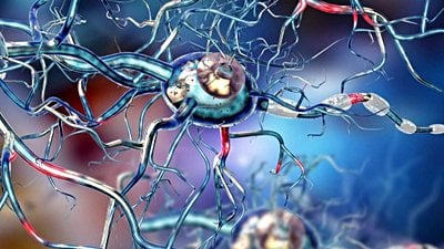 Huntington Hastalığı Nedir?