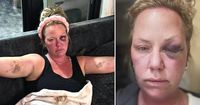 ‘It’s sickening’: Woman says she was punched in the face while on vacation in Cuba