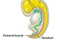 Notokord (Chorda Dorsalis)