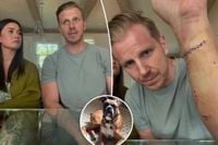 ‘Bachelor’ alum Sean Lowe attacked by his rescue dog three times in 12 hours, left ‘squirting’ blood: ‘I was fighting for my life’