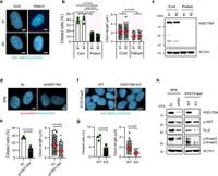 HSD17B4 deficiency causes dysregulation of primary cilia and is alleviated by acetyl-CoA - Nature Communications