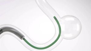 Multicenter Study Highlights Efficacy Of FRED Device For Aneurysms