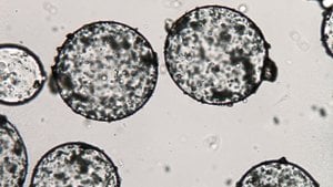 Koaservat Nedir? İlkin Koaservat Yapıları Nasıl Oluşmuştur?