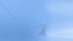 Yüzer Noktalar: Gözlerinizin Önünde Uçuşan Tuhaf Şekiller