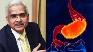 RBI Governor Shaktikanta Das Recovering From Acidity Scare