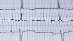 Nobele Göz Kırpan El Yazısı: E-K-G