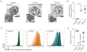 Revolutionary Insights Into Codanin-1's Role Unveiled