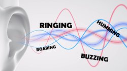 Tinnitus (Kulakda Çınlama)  Nedir ?