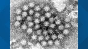 Norovirus Cases Surge Alarmingly In Toyama Prefecture