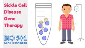 NHS Approves Landmark Gene Therapy For Sickle Cell Disease