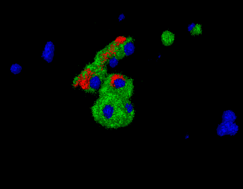 Elde ettiğimiz görüntülerin 3 boyutlu rekonstrüksiyonu