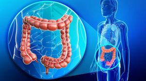 Dietary Factors Linked To Rising Bowel Cancer Rates