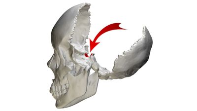 Kafatasında Bulunan Sella Turcica (Türk Eyeri) Nedir?