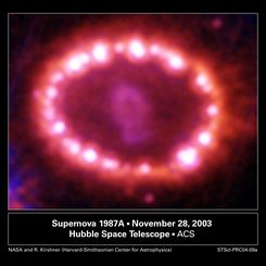 SN1987A's Cosmic Pearls