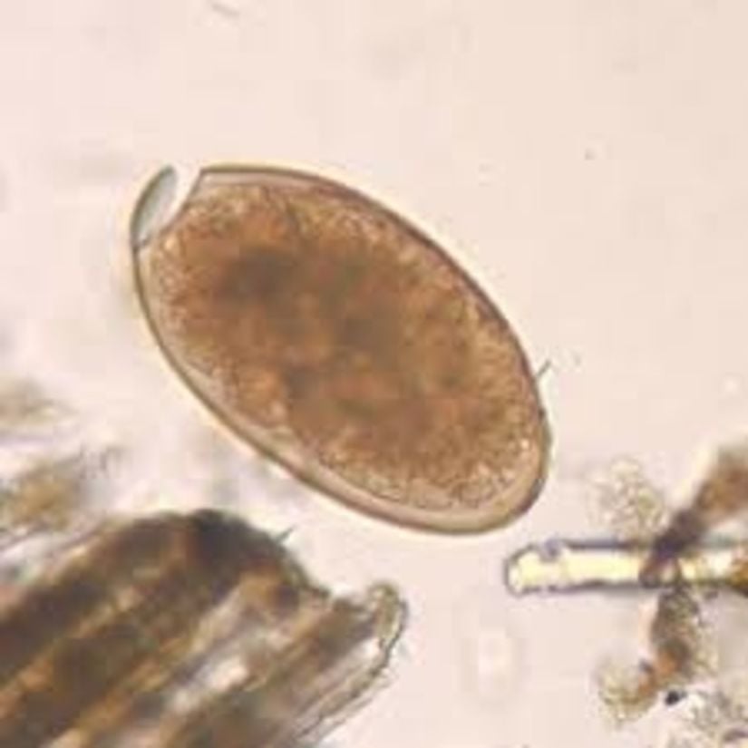 Fasciola hepatica yumurtası.