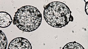 Koaservat Nedir? İlkin Koaservat Yapıları Nasıl Oluşmuştur?