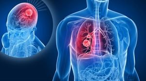 Combining Radiotherapy With Immunotherapy For NSCLC Patients