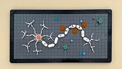 Multiple Skleroz'a Evrimsel Bakış: Neden Başka Hiçbir Türde Spontan MS Gözlenmiyor?