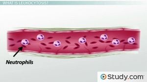 Understanding How Systemic Inflammation Shapes Health Outcomes