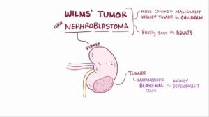 Mutations Disrupting ENL Proteins Impede Kidney Development