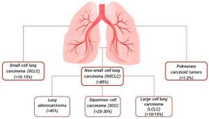 Lung Cancer Prognosis Enhanced By Microbial And Genetic Insights