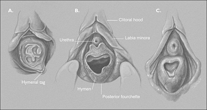 Vajinal Anatomi ve Hymen