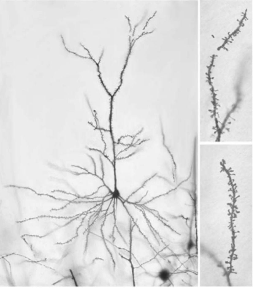 Şekil 1: Bir nöronun fotoğrafı. Soldaki görünümde, geniş dendritik ağa sahip dendritik alan görülüyor. Sağda, sinapsların çoğunun yer aldığı dikenleri gösteren dendritik dalların daha yüksek güçlü görüntüleri yer alıyor. Dendritik uzunlukta, omurga yoğunluğunda veya her ikisinde de bir artış varsa, nöronda daha fazla sinaps olduğu varsayılır.