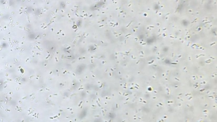 Bakteriler (Bacteria)
