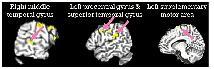 Acheulian bilişsel ağını biçimlendiren beyin bölümleri, ayrıca piyanistler piyano çalışırken de aktif.