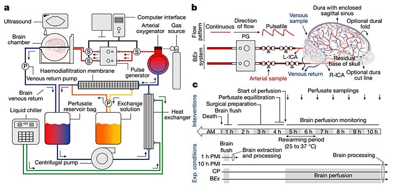 BrainEx'in nasıl çalıştığını gösteren bir şema