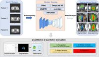 A deep learning model based on Mamba for automatic segmentation in cervical cancer brachytherapy - Scientific Reports