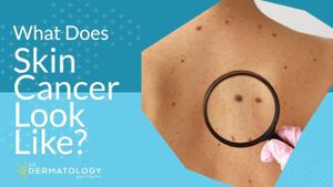 Revolutionary Indoor Positioning System Enhances Melanoma Detection