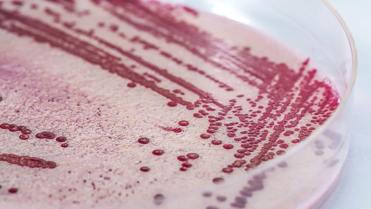 Health Crisis Emerges As Listeria Outbreak Hits Yu Shang Food The Pinnacle Gazette