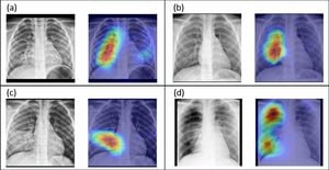 New MedMNIST+ Dataset Collection Enhances Medical Image Benchmarking